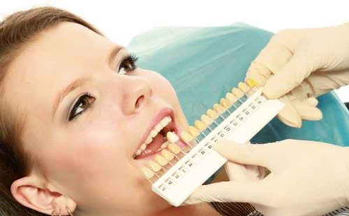 ایمپلنت ؛ مطلوب ترین جایگزین دندان های از دست رفته