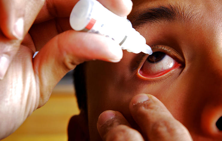 عادات و عوامل مضر برای چشم ها