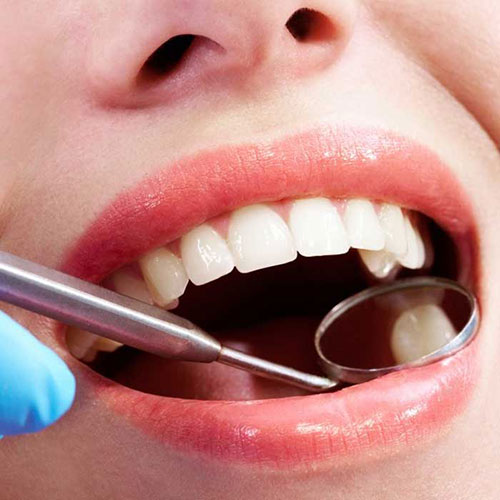 علت حساس شدن دندان ها و راه های درمان آن