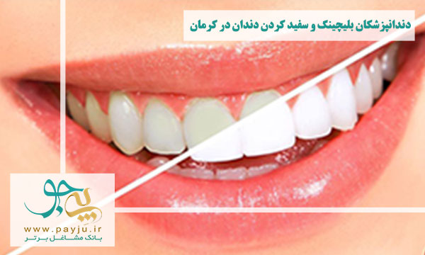 لیست دندانپزشکان بلیچینگ و سفید کردن دندان در کرمان