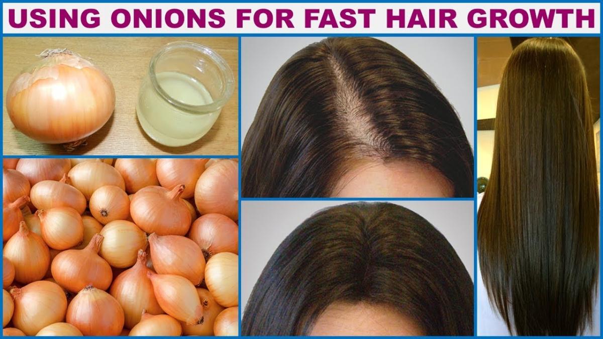 11 ماسک پیاز برای افزایش رشد مو و درمان شوره سر