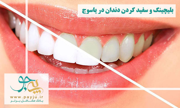 لیست دندانپزشکان بلیچینگ و سفید کردن دندان در یاسوج