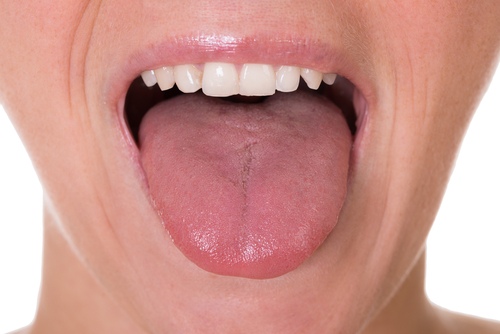 آشنایی با انواع مشکلات و خطرات زخم های زبان