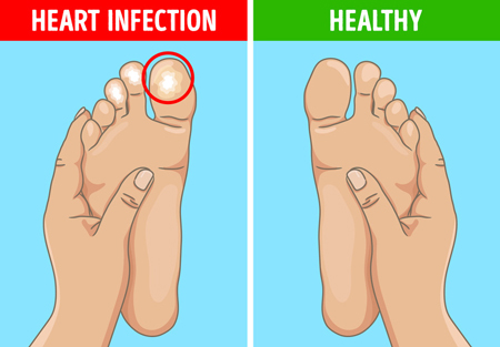 این علائم در پاها نشان دهنده مشکل در ارگانهای داخلی بدن شماست!