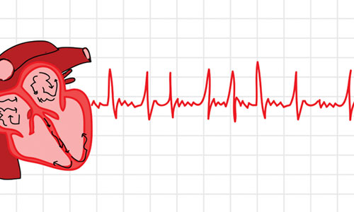آزمایش‌ها و تست‌های تشخیصی آریتمی قلب