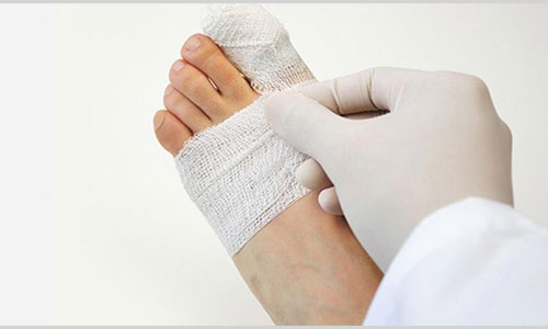 درد انگشت پا به علت شکستگی یا پیچ خوردگی؟