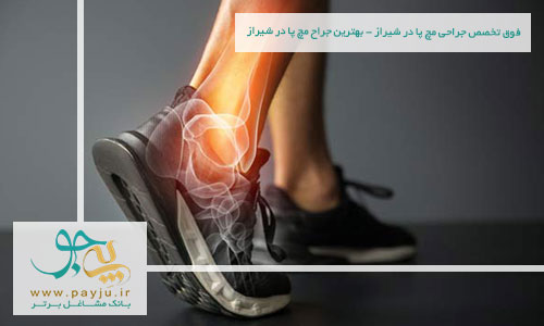 فوق تخصص جراحی مچ پا در شیراز - بهترین جراح مچ پا در شیراز