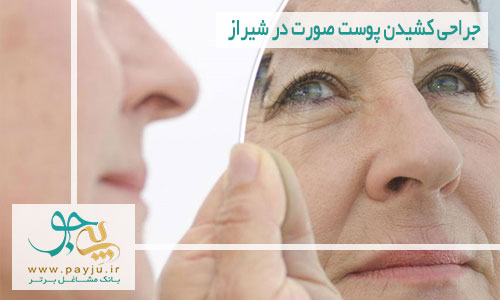 جراحی کشیدن پوست صورت در شیراز