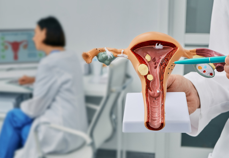 برآمدگی در واژن : 10 علت شایع و نحوه درمان آنها
