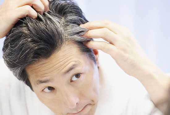 پیشگیری از زود سفید شدن مو ها