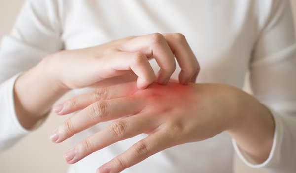 9 راه درمان خانگی قارچ پوستی