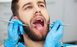 دکتر پر کردن دندان بجنورد