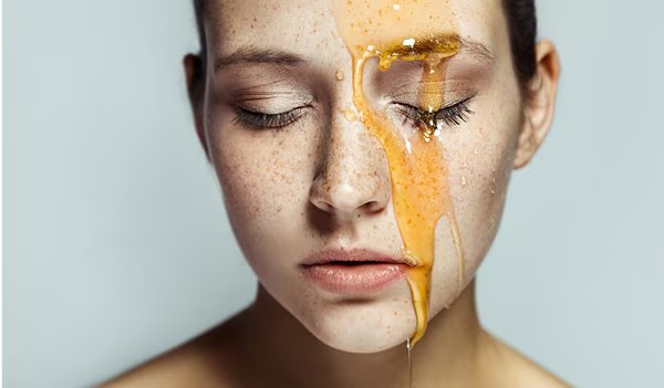 درمان پوست چرب با عسل