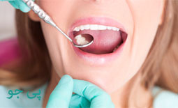 دکتر پر کردن دندان خرم آباد