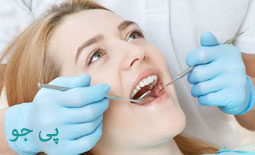 دکتر روکش دندان مشهد