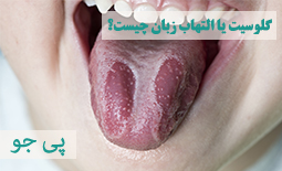 التهاب زبان یا گلوسیت چیست؟ علائم، علل و درمان 
