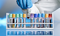 لیست آزمایشگاه های تشخیص طبی در همدان