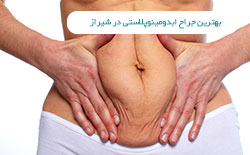 جراح ابدومینوپلاستی در شیراز