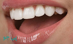لیست دندانپزشکان متخصص بلیچینگ و سفید کردن دندان در زنجان