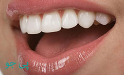 لیست دندانپزشکان بلیچینگ و سفید کردن دندان در اهواز