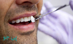 لیست دندانپزشکان بلیچینگ و سفید کردن دندان در مشهد