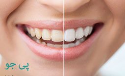 لیست دندانپزشکان بلیچینگ و سفید کردن دندان در یاسوج