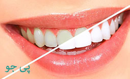 لیست دندانپزشکان بلیچینگ و سفید کردن دندان در کرمان