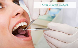 کامپوزیت دندان در ارومیه