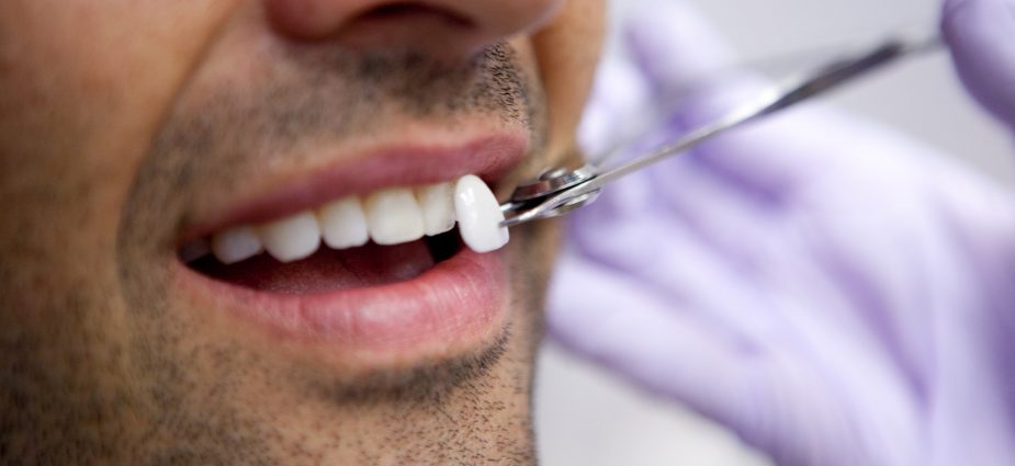 لیست دندانپزشکان متخصص لمینت دندان در شیراز