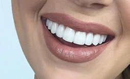 لیست دندانپزشکان زیبایی و ترمیمی در همدان