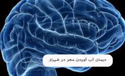 درمان آب آوردن مغز در شیراز