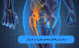 درمان دررفتگی مفصل هیپ در شیراز