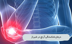 درمان شکستگی آرنج در شیراز