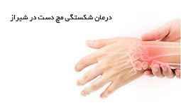 درمان شکستگی مچ دست در شیراز