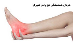 درمان شکستگی مچ پا در شیراز