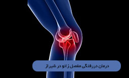 درمان دررفتگی مفصل زانو در شیراز