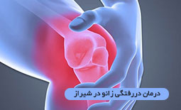 درمان دررفتگی زانو در شیراز