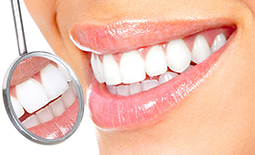 دندانپزشکان متخصص فیسینگ دندان و اصلاح طرح لبخند در شیراز