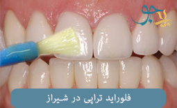 فلوراید تراپی دندان در شیراز