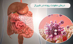 درمان عفونت روده در شیراز