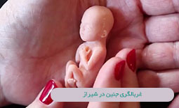 غربالگری جنین در شیراز
