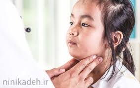 بیماری اوریون در کودکان چیست؟