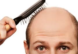  درمان ریزش مو در بندرعباس