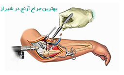بهترین جراح آرنج در شیراز
