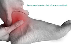 فوق تخصص جراحی مچ پا در شیراز - بهترین جراح مچ پا در شیراز