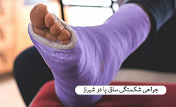 جراحی شکستگی ساق پا در شیراز