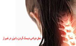 عمل جراحی دیسک گردن با لیزر در شیراز