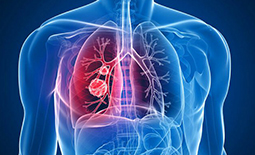 لیست پزشکان فوق تخصص ریه در اهواز