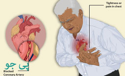 آنژین قلبی چیست؟