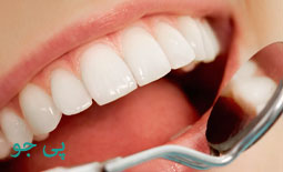 فیسینگ دندان چیست؟